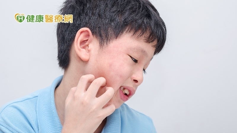 Chú ý 6 triệu chứng “phát ban, nứt nẻ, đau, đỏ, sưng, nóng” để biết được có bị dị ứng thuốc hay không