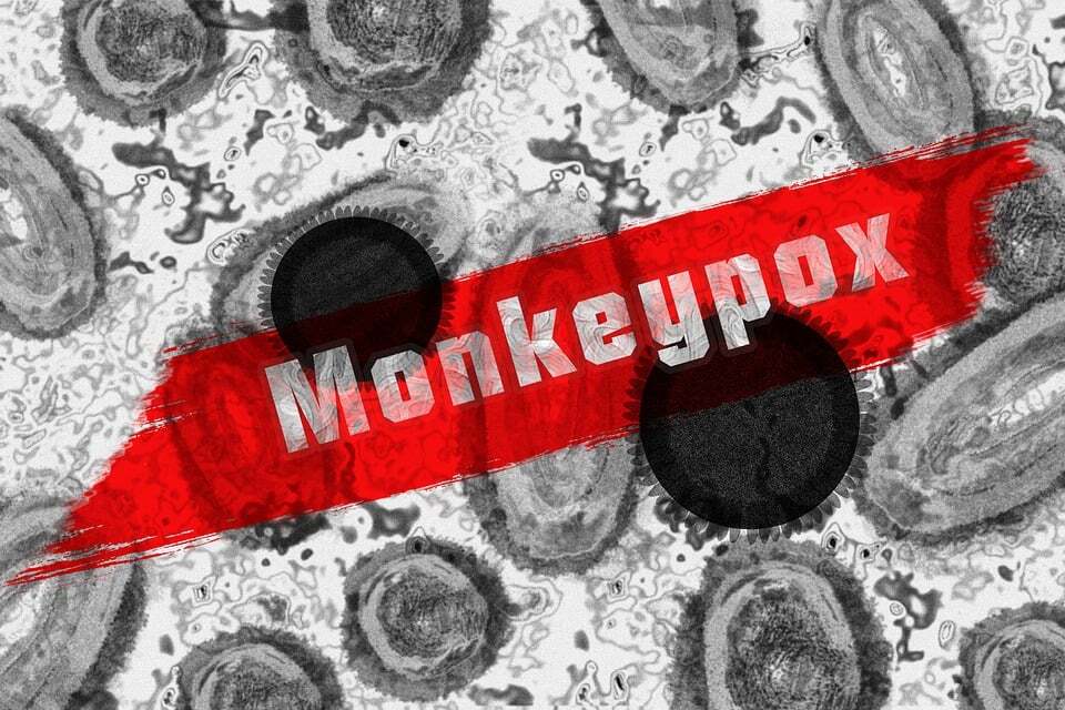 Dịch bệnh Mpox ở miền Nam Việt Nam trầm trọng, trong 20 tháng ghi nhận 199 ca và 8 trường hợp tử vong